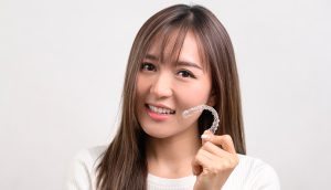Smile Makeover Orthodontics