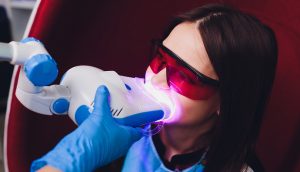 Smile Makeover Teeth Whitening