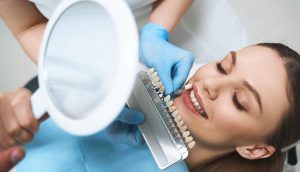 Smile Makeover Veneers